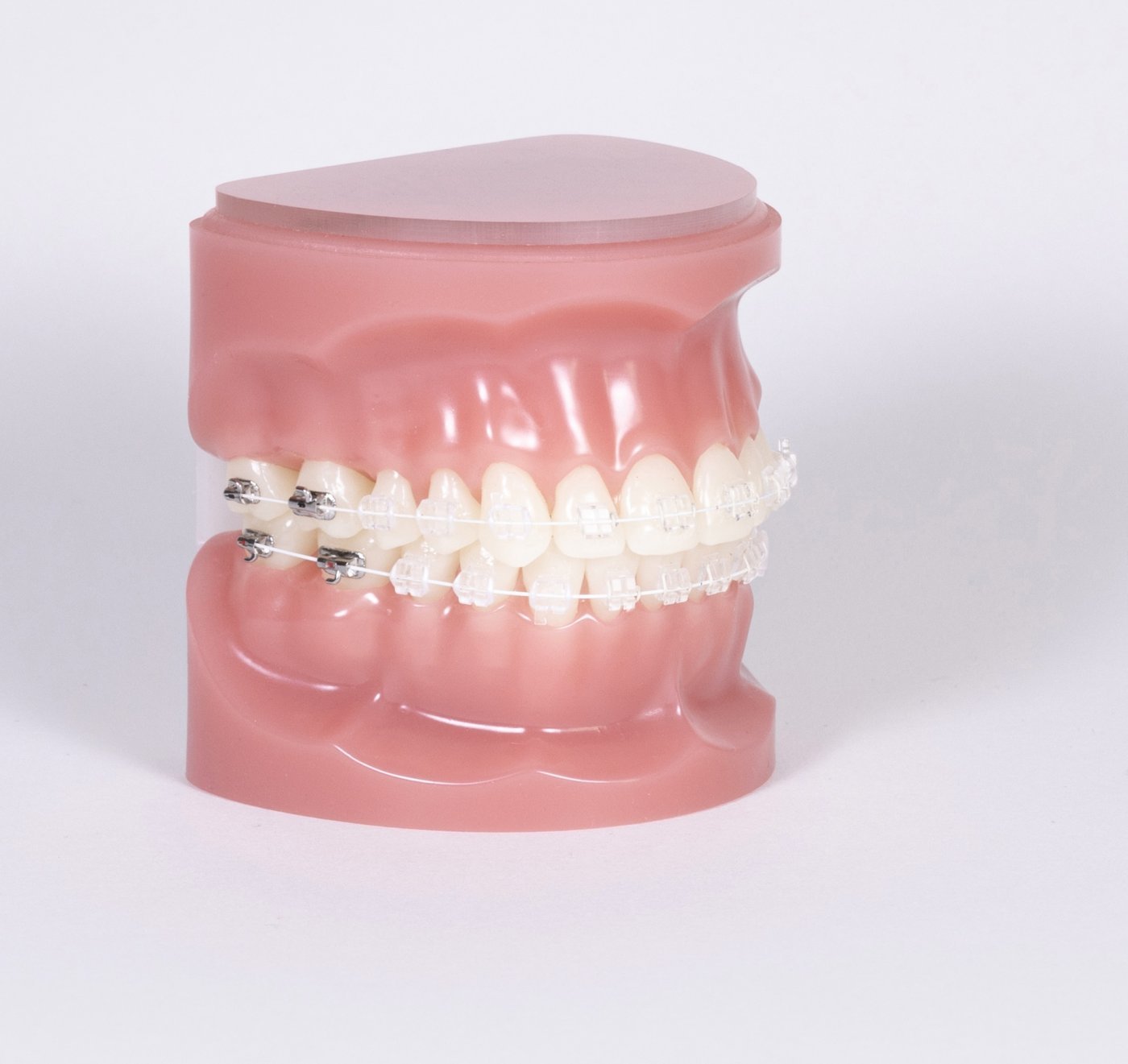 Zubní rovnátka cena, ceny rovnátek | Perfect Smile s.r.o. Praha