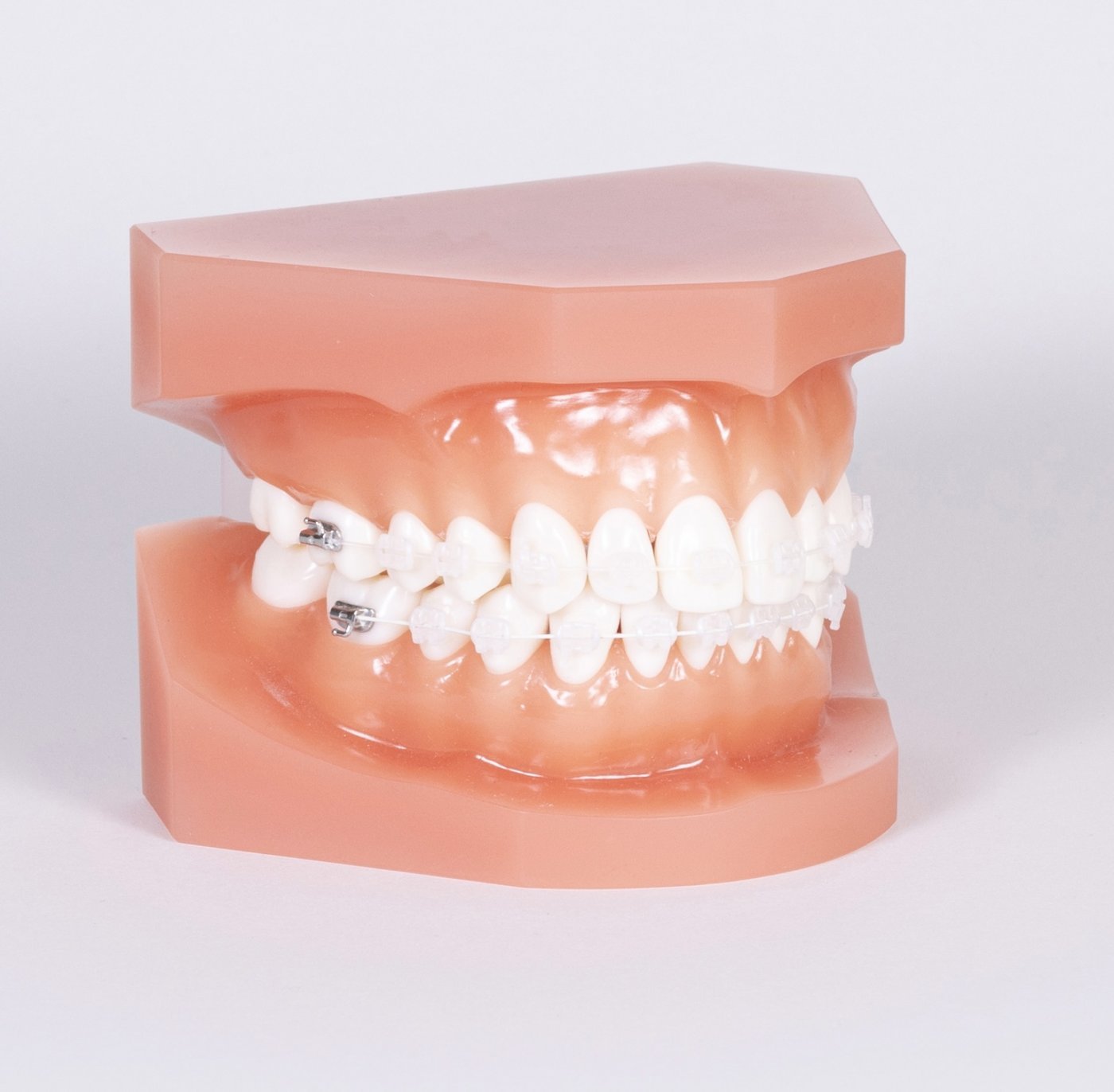 Zubní rovnátka cena, ceny rovnátek | Perfect Smile s.r.o. Praha