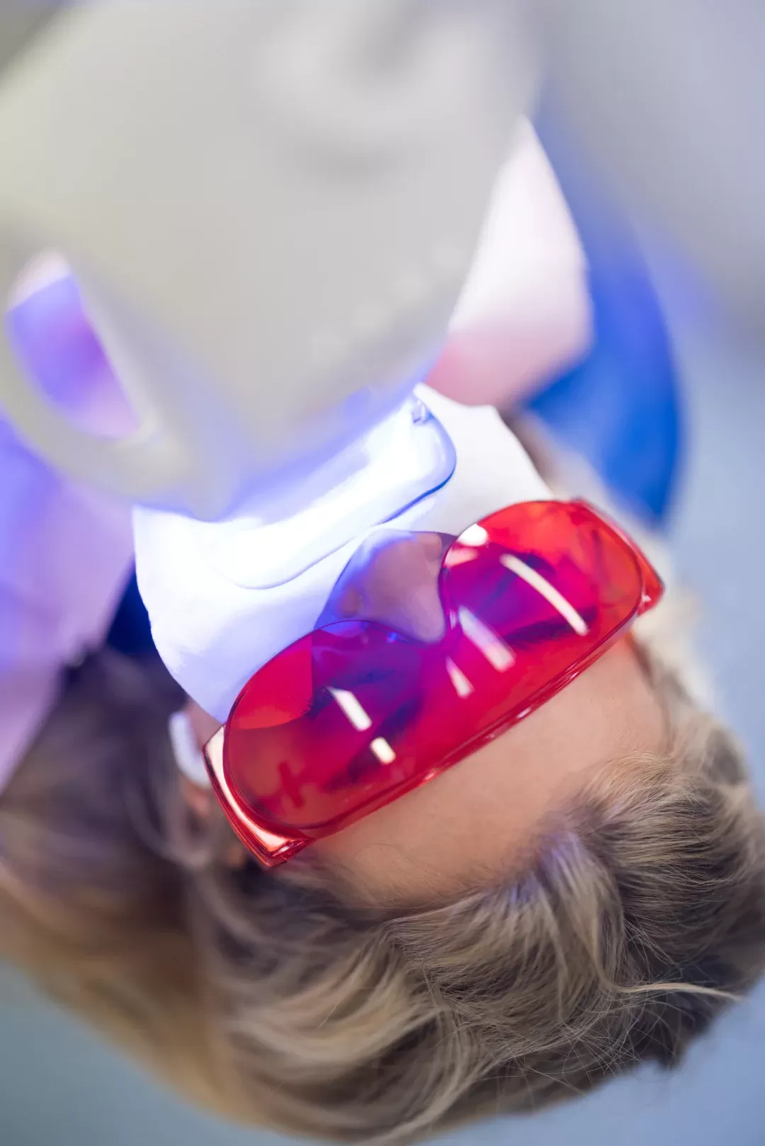 The ZOOM teeth whitening process The ZOOM teeth whitening process